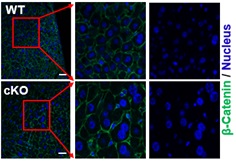 Ceramide Synthases 2 Plays a Critical Role in Maintenance of Liver Homeostasis