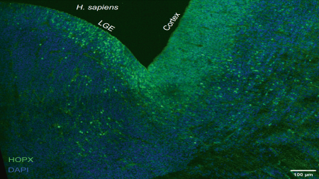 Evolutionarily Conservative and Non-conservative Regulatory Networks during Primate Interneuron Development