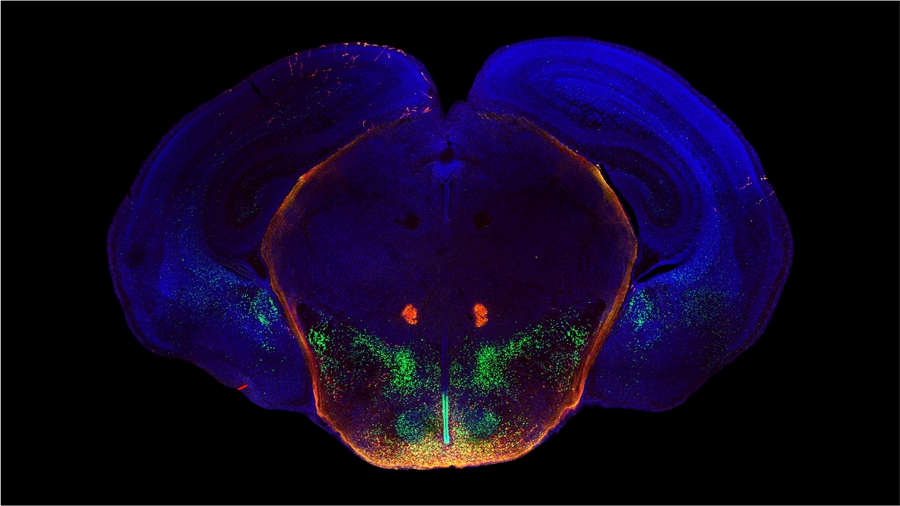 How is Puberty Onset Developmentally Programmed?