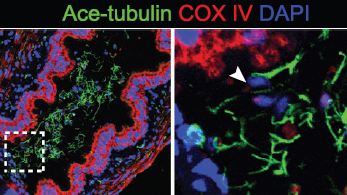 Scientists Reveal New Mechanism for Dynamic Regulation of Manchette Microtubules During Sperm Development