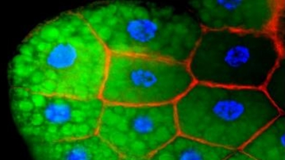 Lipid traffic jam: Chinese scientists reveal how dAcsl orchestrates lipid transport in Drosophila