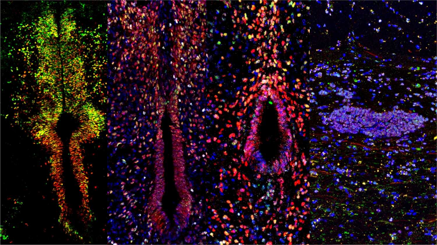 Study Unveils Differential Lineage Plasticity of Ependymal Cells and Astrocytes in Spinal Cord Injury Repair