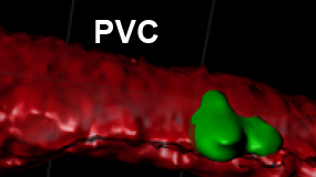 Study Reveals&nbsp;a Novel Mechanism Behind Electrical Synapse Formation